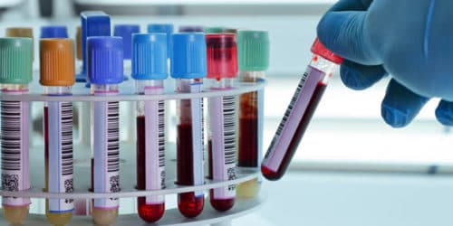 Circulerende micro-RNA’s voorspellen prognose vroegstadium NSCLC
