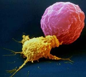 Off-labelgebruik binnen de oncologie in kaart gebracht