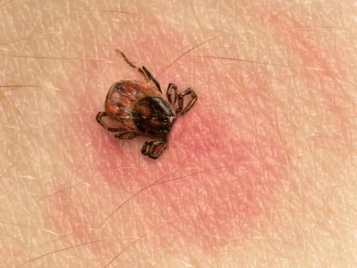 Nieuwe adviezen over ziekte van Lyme-artritis