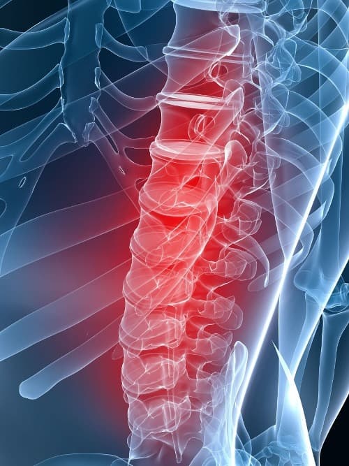 Bimekizumab blijft effectief en veilig bij r-axSpA na vijf jaar