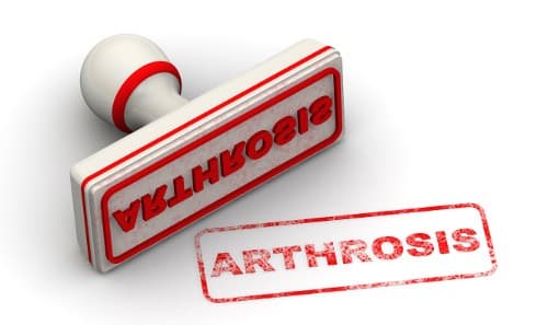 Verhoogde prevalentie artrose bij mensen met MS