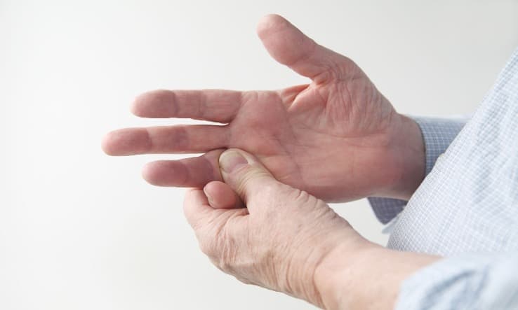 Succesvol stoppen met prednisolon na kortdurende overbrugging bij nieuwe RA-patiënten