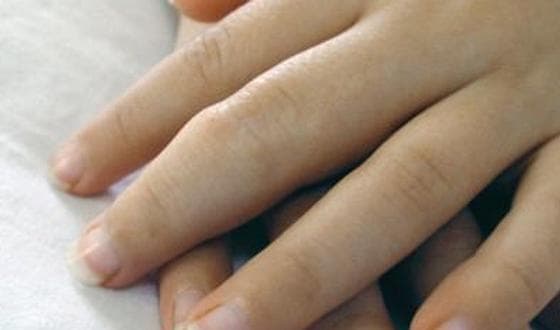 Baricitinib effectieve optie voor patiënten met JIA