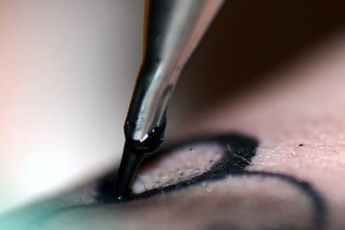 Patiënten tevreden over medische tatoeage bij capillaire malformaties