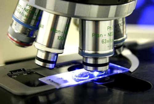 CD133 niet geschikt voor detectie leukemiestamcellen bij AML