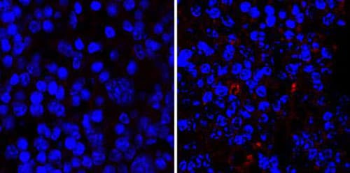 Deciphering the link between skin allergies and the gut microbiota