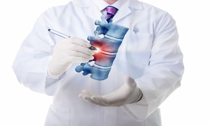 EULAR 2020: Kosteneffectiviteit van diagnostische algoritmen voor axiale SpA