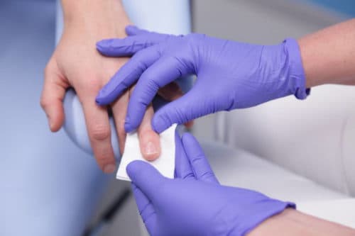 Lager risico op reumatoïde artritis bij patiënten met diabetes type 2