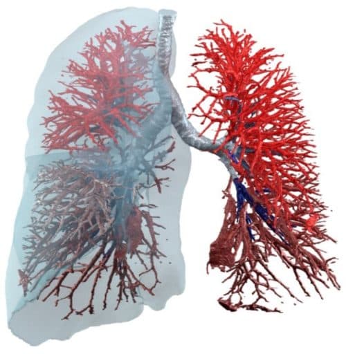 Relatie tussen bloedeosinofielen en alveolaire schade bij COPD