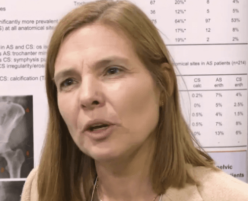 ACR 2019: Video met dr. Anneke Spoorenberg, UMCG Groningen