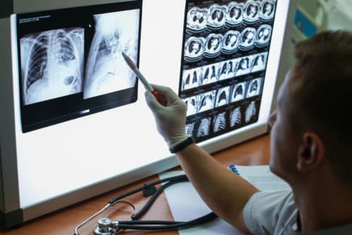 ATS 2020: COPD-patiënten kennen verschillende exacerbatie-trajecten