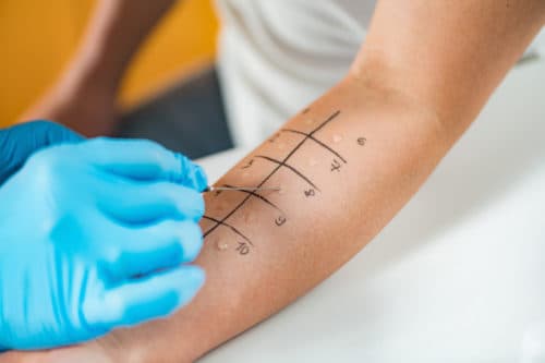 OCD het vaakst door rubberversnellers, epoxyharsen en conserveringsmiddelen