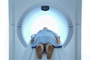 Beeldvorming bij PMR: PET/CT vooral geschikt om diagnose uit te sluiten