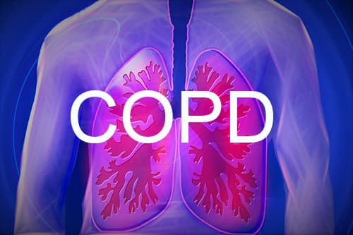 Triple-therapie verlaagt mortaliteit bij ernstig COPD