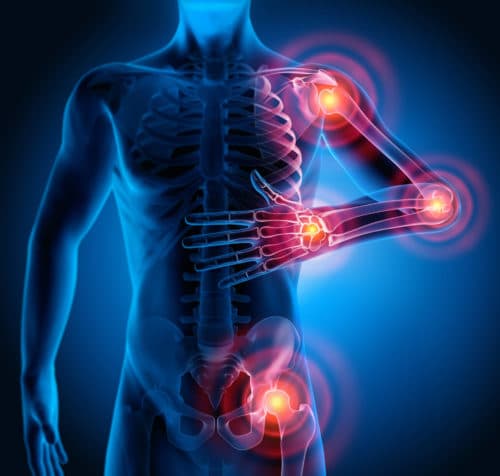 Vagusstimulatie vermindert ziekteactiviteit bij therapieresistente RA