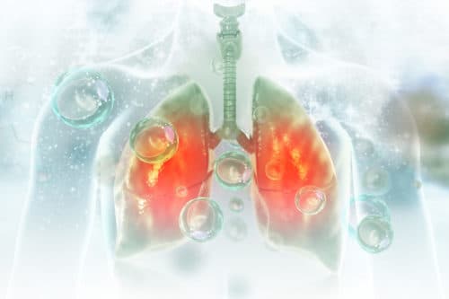 Meer risico op pneumonitis door checkpointremmer bij longziekten