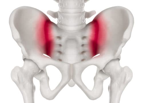 ACR 2020: Accurate bepaling van radiografische sacroiliitis met AI