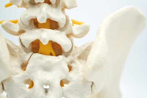 Treat-to-target bij axiale spondyloartritis