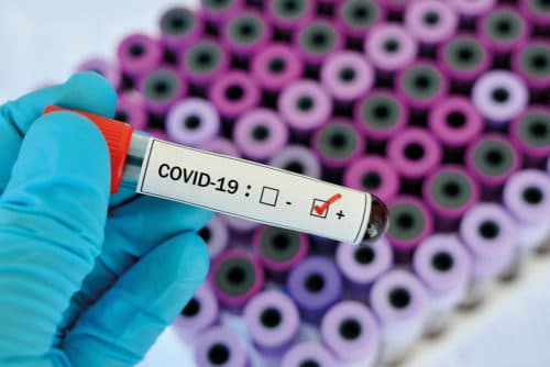 Laboratoriumdiagnostiek bij COVID-19