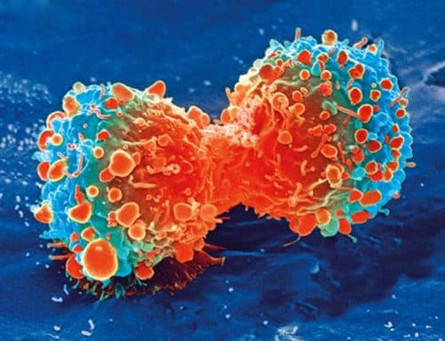Bepaling van PD-L1 expressie niet beïnvloed door inflammatie