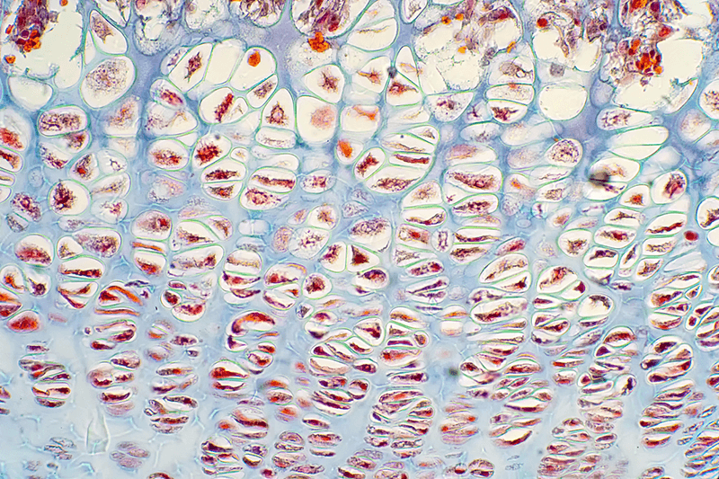 Gemanipuleerd kraakbeen geeft anti-inflammatoir geneesmiddel af