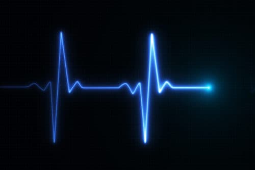 ATS 2021: P-pulmonale op ECG is geassocieerd met COPD-exacerbaties