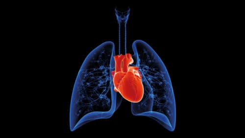 Nomogram met CT-thorax-data identificeert cardiovasculaire ziekte bij COPD