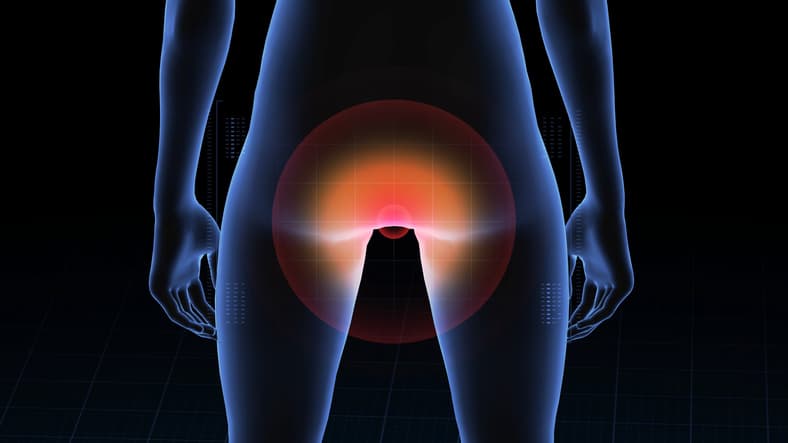 Rectumkanker: minder (chemo)radiotherapie, evenveel recidieven