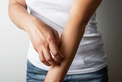 Geen verband spiegel dupilumab en respons bij atopische dermatitis