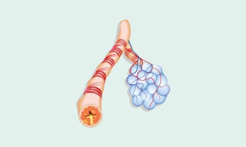 Bronchiale hyperreactiviteit bij (ernstig) astma