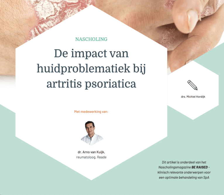 De impact van huidproblematiek bij artritis psoriatica