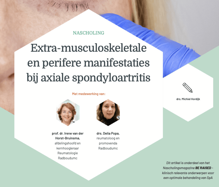 Extra-musculoskeletale en perifere manifestaties bij axiale spondyloartritis