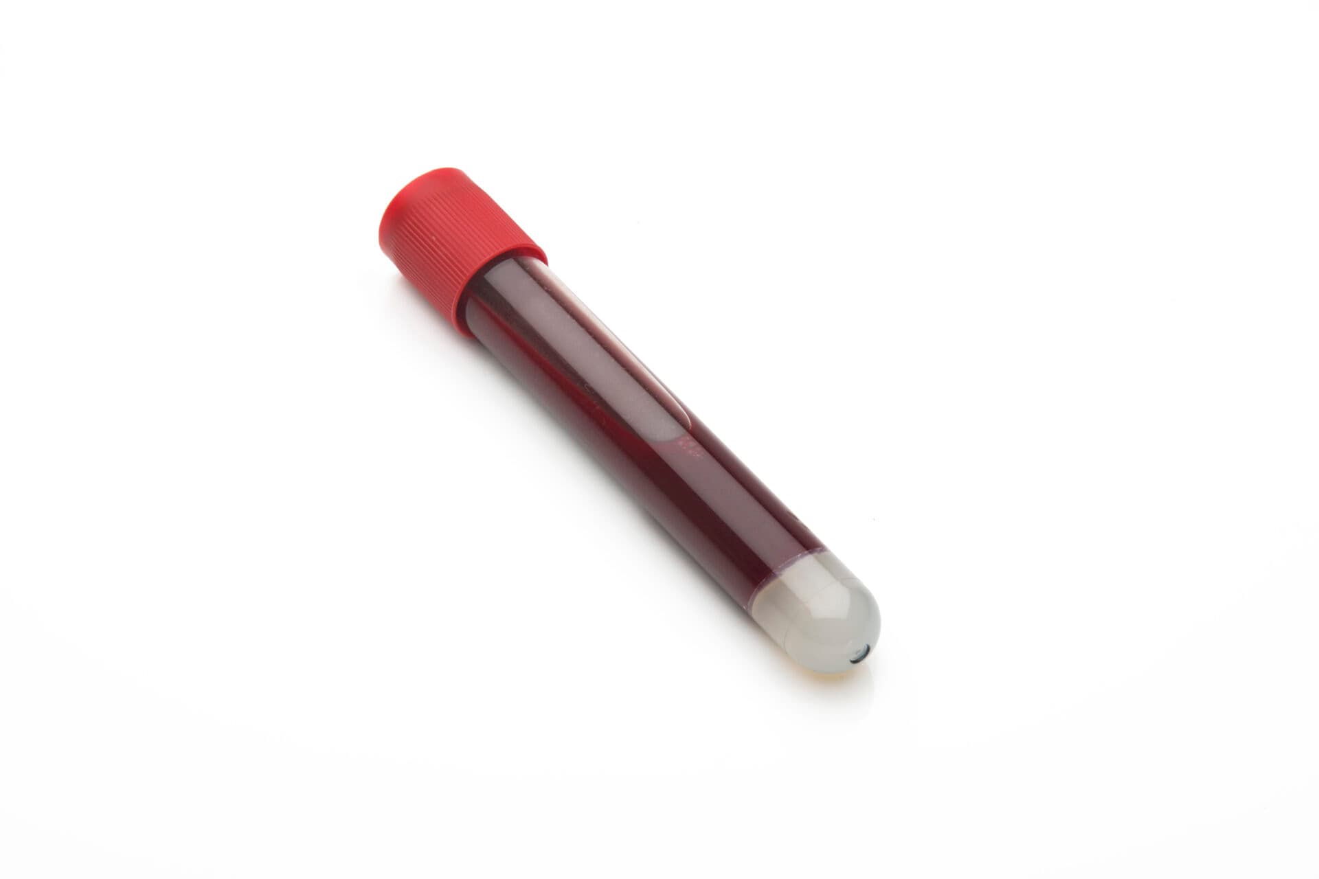LIBELULE: liquid biopsy vooraf haalde in de intention-to-treat maar vijf dagen winst
