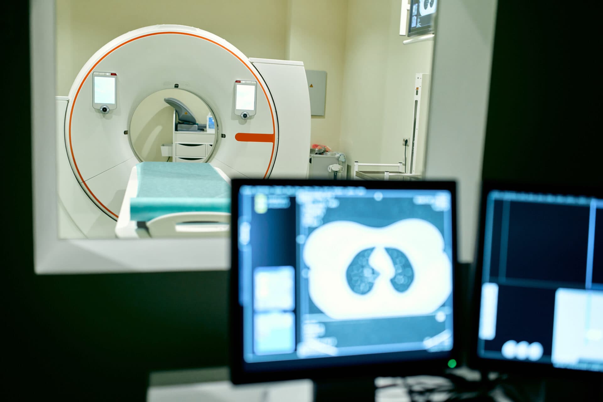 Wat is niet-kleincellig longcarcinoom (NSCLC)? Symptomen, diagnose en behandeling